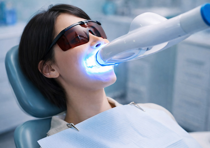 オフィスホワイトニングのための専用の光